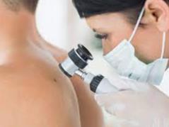 Dermatology - Lesions and Lumps